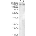 Western Blot - Anti-AVPR1B Antibody (A84559) - Antibodies.com