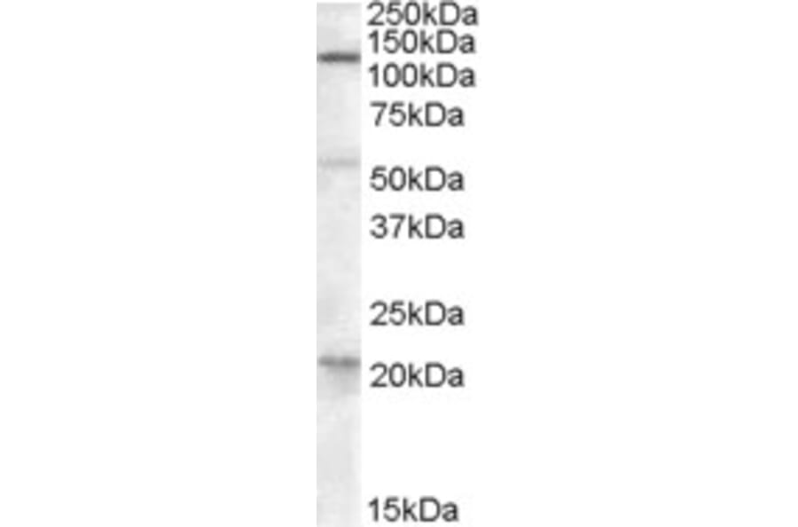 Western Blot - Anti-DAGLA Antibody (A84560) - Antibodies.com