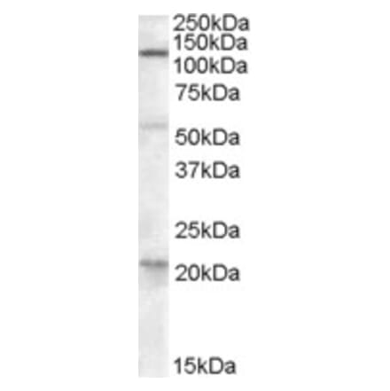 Western Blot - Anti-DAGLA Antibody (A84560) - Antibodies.com