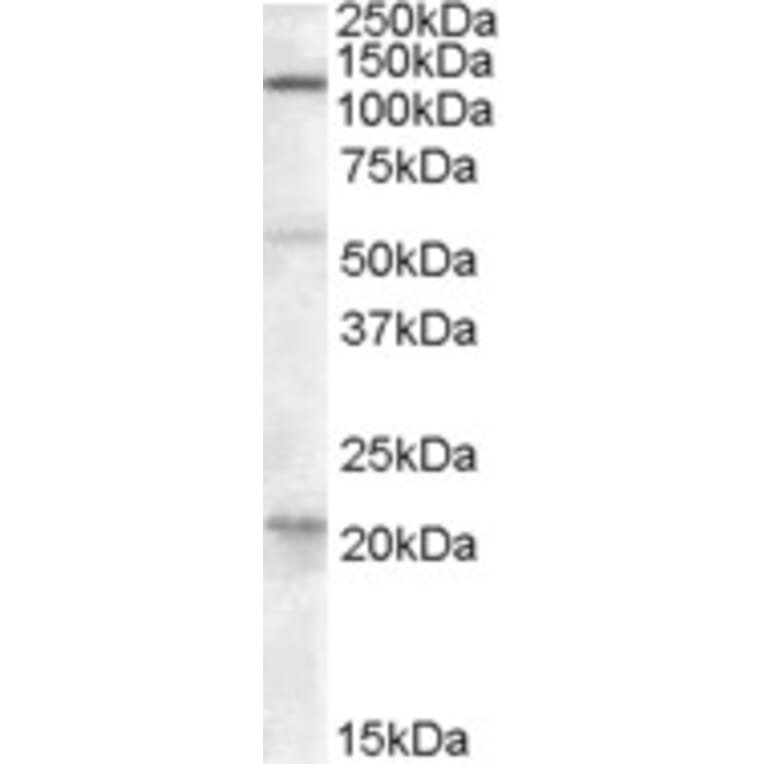 Western Blot - Anti-DAGLA Antibody (A84560) - Antibodies.com