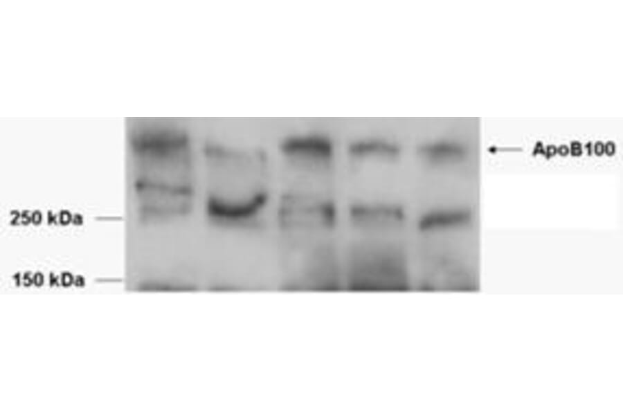 Western Blot - Anti-Apolipoprotein B Antibody (A84561) - Antibodies.com
