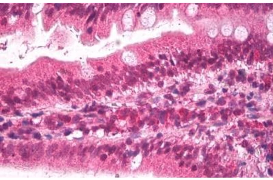 Immunohistochemistry - Anti-Apolipoprotein B Antibody (A84561) - Antibodies.com
