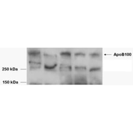 Western Blot - Anti-APOB Antibody (A84561) - Antibodies.com