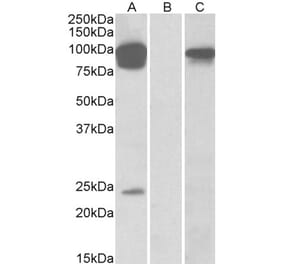 Western Blot - Anti-TRPV3 Antibody (A84562) - Antibodies.com