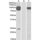 Western Blot - Anti-TRPV3 Antibody (A84562) - Antibodies.com