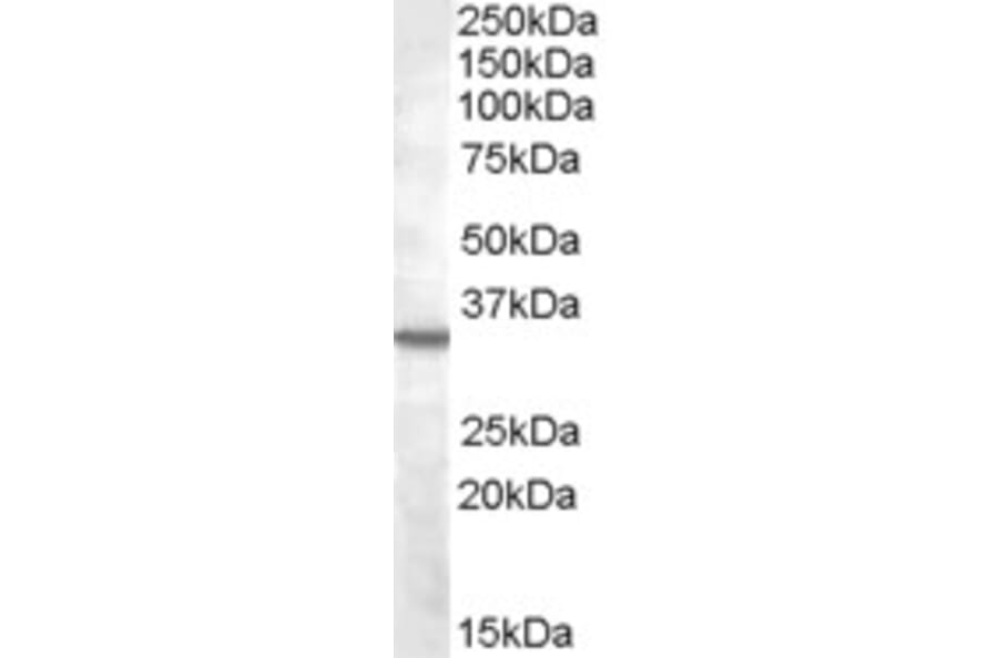 Western Blot - Anti-B1R Antibody (A84563) - Antibodies.com