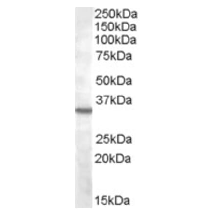 Western Blot - Anti-B1R Antibody (A84563) - Antibodies.com