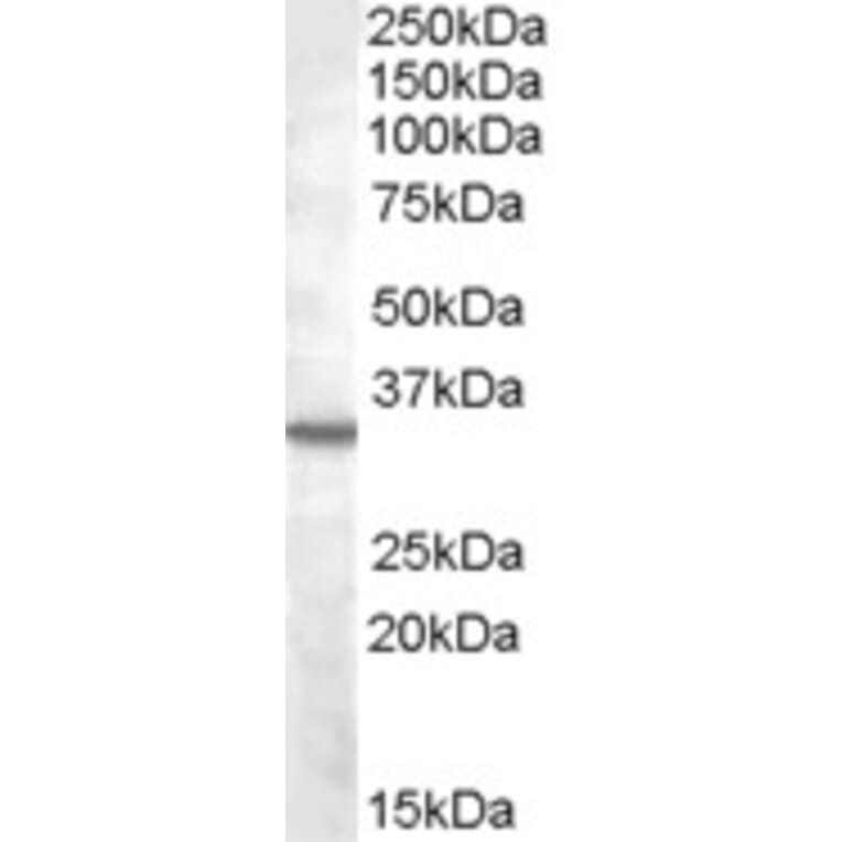 Western Blot - Anti-B1R Antibody (A84563) - Antibodies.com