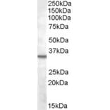 Western Blot - Anti-B1R Antibody (A84563) - Antibodies.com