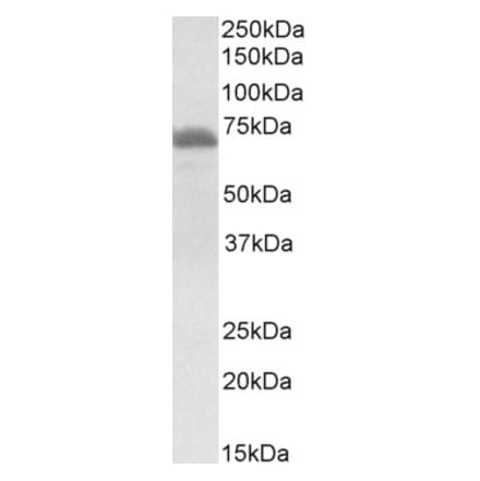 Western Blot - Anti-ITK Antibody (A84564) - Antibodies.com