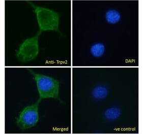 Immunofluorescence - Anti-TRPV2 Antibody (A84565) - Antibodies.com