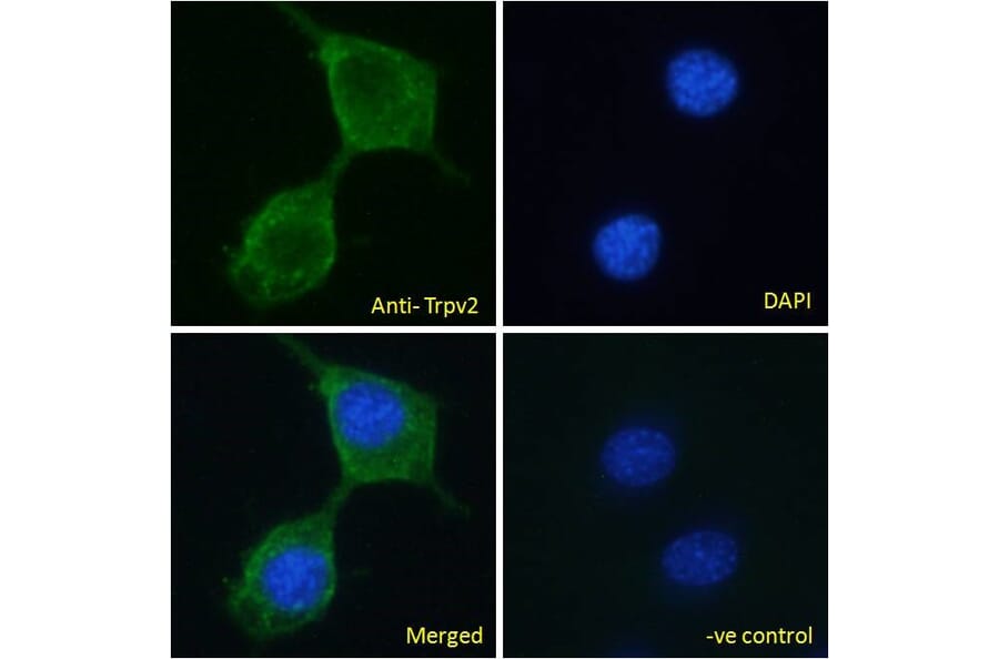 Immunofluorescence - Anti-TRPV2 Antibody (A84565) - Antibodies.com