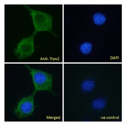 Immunofluorescence - Anti-TRPV2 Antibody (A84565) - Antibodies.com