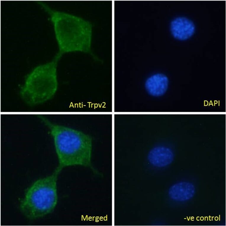 Immunofluorescence - Anti-TRPV2 Antibody (A84565) - Antibodies.com