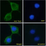 Immunofluorescence - Anti-TRPV2 Antibody (A84565) - Antibodies.com
