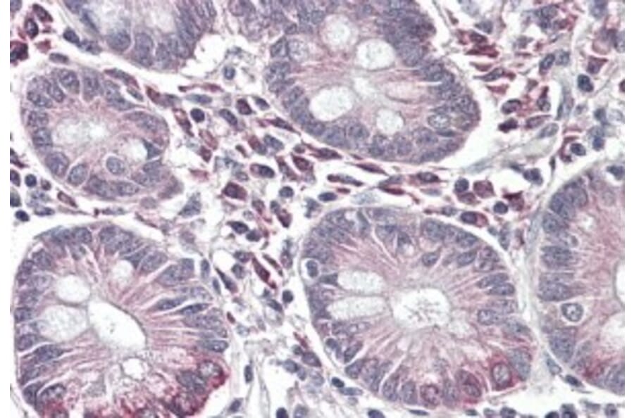 Immunohistochemistry - Anti-SLC10A2/ASBT Antibody (A84566) - Antibodies.com