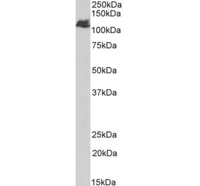 Western Blot - Anti-BMPR2 Antibody (A84568) - Antibodies.com