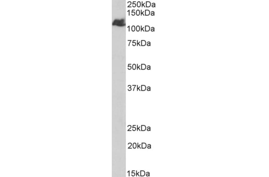 Western Blot - Anti-BMPR2 Antibody (A84568) - Antibodies.com