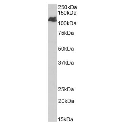 Western Blot - Anti-BMPR2 Antibody (A84568) - Antibodies.com