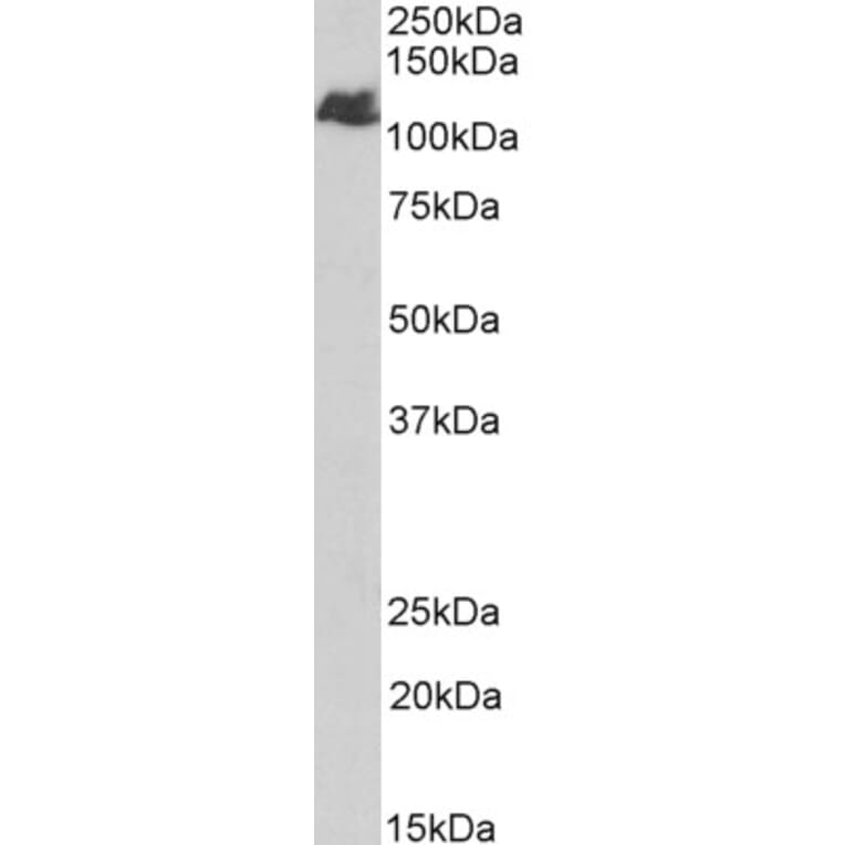 Western Blot - Anti-BMPR2 Antibody (A84568) - Antibodies.com