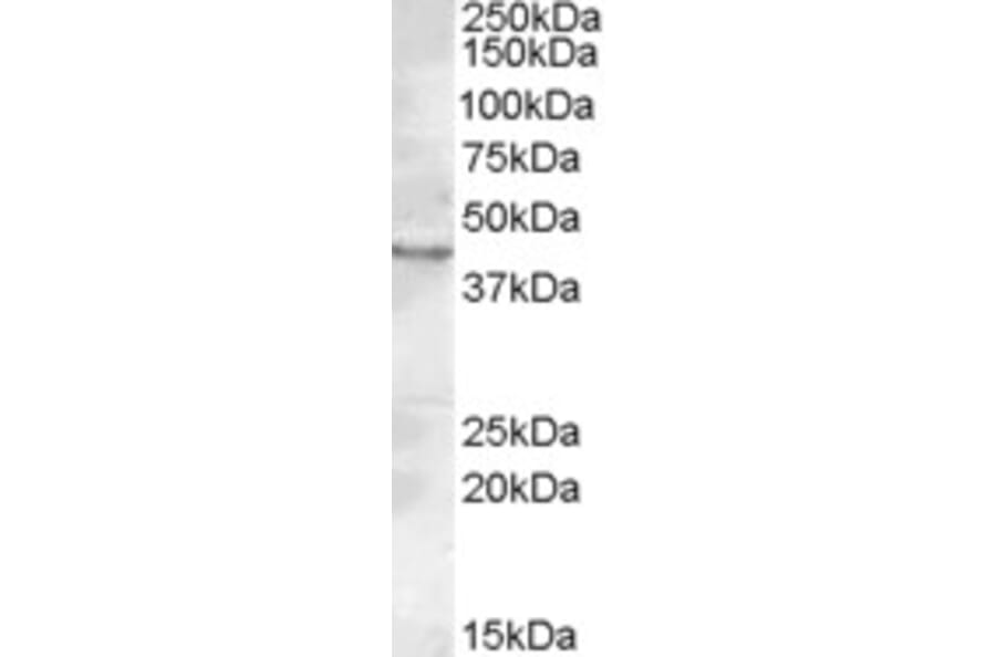 Western Blot - Anti-LASS3 Antibody (A84569) - Antibodies.com