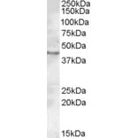 Western Blot - Anti-LASS3 Antibody (A84569) - Antibodies.com