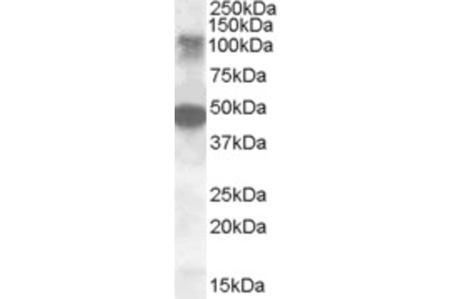 Western Blot - Anti-LIP1 Antibody (A84572) - Antibodies.com