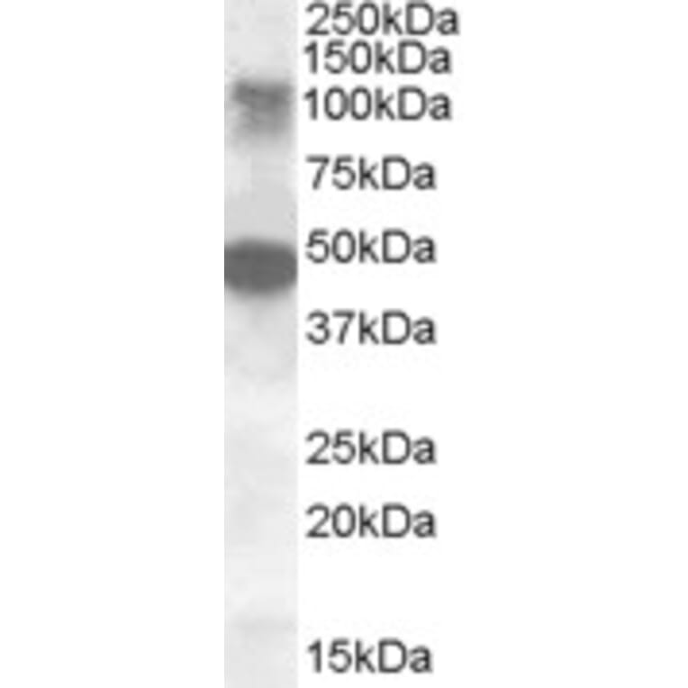 Western Blot - Anti-LIP1 Antibody (A84572) - Antibodies.com