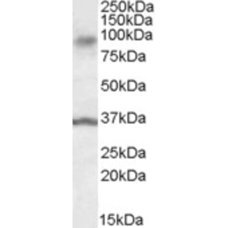 Western Blot - Anti-ANKK1 Antibody (A84573) - Antibodies.com