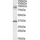 Western Blot - Anti-ANKK1 Antibody (A84573) - Antibodies.com