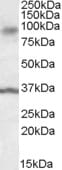 Anti-ANKK1 Antibody (A84573) (0.1µg/ml) staining of Human Substantia Nigra lysate (35µg protein in RIPA buffer). Detected by chemiluminescence.