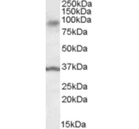 Western Blot - Anti-ANKK1 Antibody (A84573) - Antibodies.com