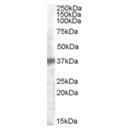Western Blot - Anti-TROP2 Antibody (A84575) - Antibodies.com