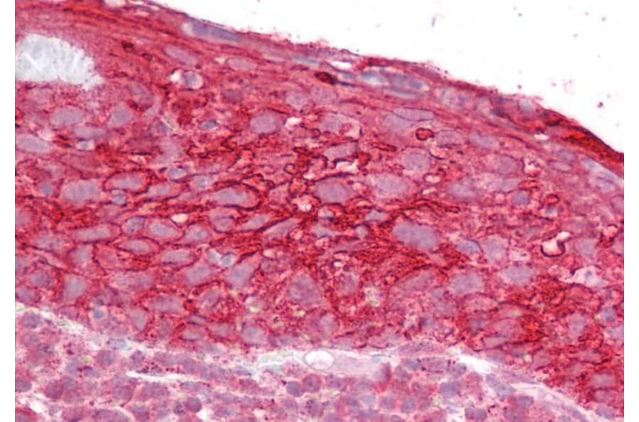 Immunohistochemistry - Anti-TROP2 Antibody (A84575) - Antibodies.com
