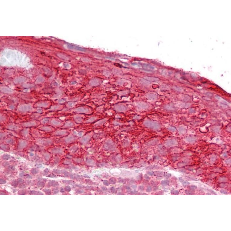 Immunohistochemistry - Anti-TROP2 Antibody (A84575) - Antibodies.com