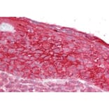Immunohistochemistry - Anti-TROP2 Antibody (A84575) - Antibodies.com
