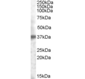 Western Blot - Anti-TACSTD2 Antibody (A84575) - Antibodies.com