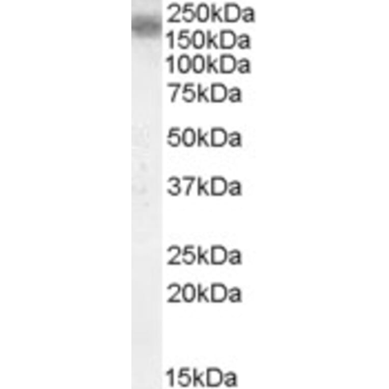 Western Blot - Anti-LRP4 Antibody (A84576) - Antibodies.com