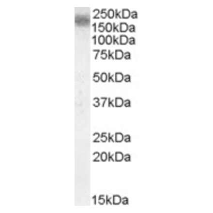 Western Blot - Anti-LRP4 Antibody (A84576) - Antibodies.com