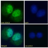 Immunofluorescence - Anti-SOX10 Antibody (A84577) - Antibodies.com