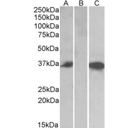 Western Blot - Anti-Mast Cell Chymase Antibody (A84581) - Antibodies.com