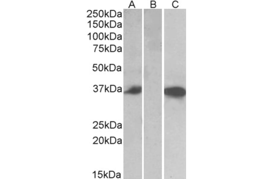 Western Blot - Anti-Mast Cell Chymase Antibody (A84581) - Antibodies.com