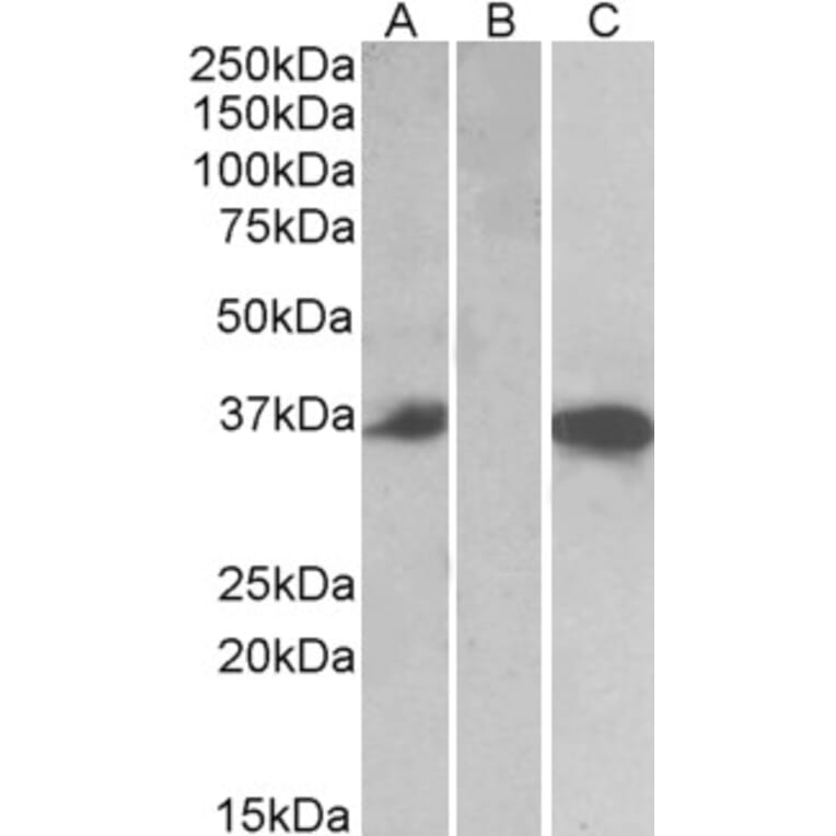 Western Blot - Anti-Mast Cell Chymase Antibody (A84581) - Antibodies.com