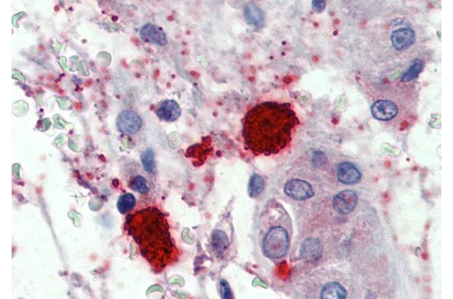 Immunohistochemistry - Anti-Mast Cell Chymase Antibody (A84581) - Antibodies.com