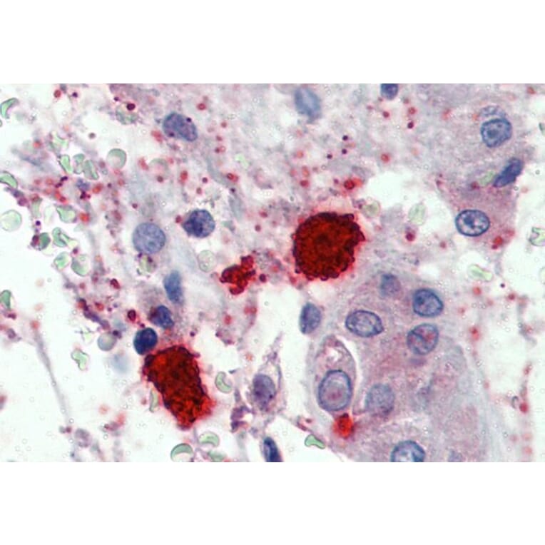 Immunohistochemistry - Anti-Mast Cell Chymase Antibody (A84581) - Antibodies.com