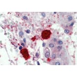 Immunohistochemistry - Anti-Mast Cell Chymase Antibody (A84581) - Antibodies.com