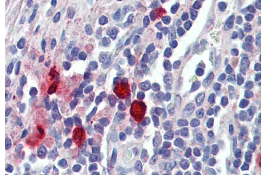 Immunohistochemistry - Anti-Mast Cell Chymase Antibody (A84581) - Antibodies.com