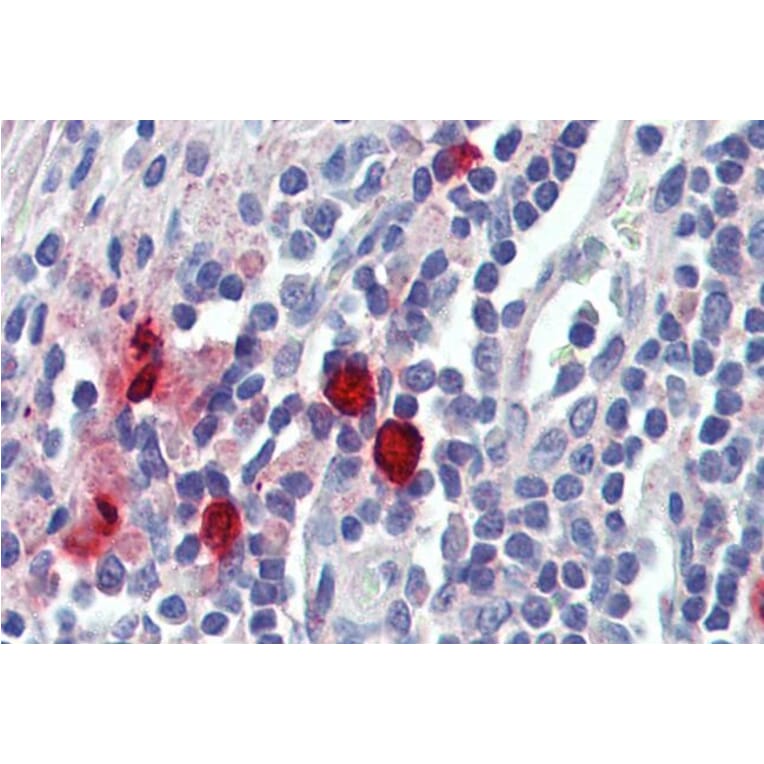 Immunohistochemistry - Anti-Mast Cell Chymase Antibody (A84581) - Antibodies.com