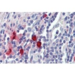 Immunohistochemistry - Anti-Mast Cell Chymase Antibody (A84581) - Antibodies.com