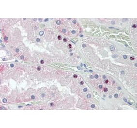 Immunohistochemistry - Anti-HOXD10 Antibody (A84582) - Antibodies.com